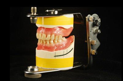 噛みやすい最新入れ歯の種類と値段 - 岐阜県入れ歯専門外来・桐山歯科医院（岐阜市）