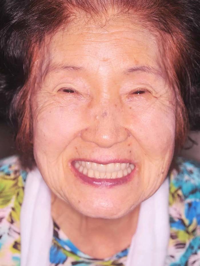 ゲルバーデンチャーで にっこり笑う患者さま