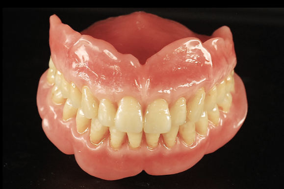最新総入れ歯ヨーロッパ式のゲルバーデンチャー - 桐山歯科医院入れ歯専門外来